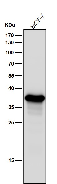 AKR1C3 Ab