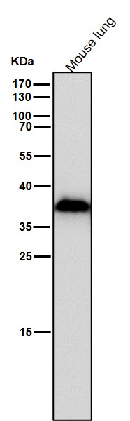 AKR1C3 Ab