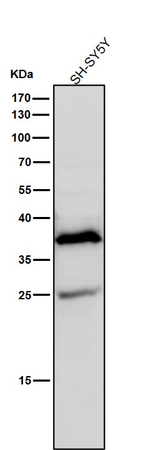 AKR1C3 Ab