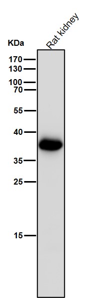 AKR1C3 Ab