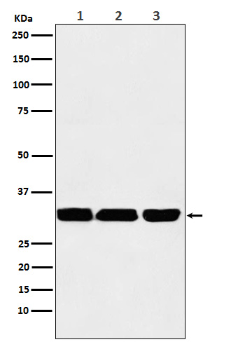 p53 DINP1 Ab