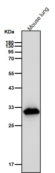 p53 DINP1 Ab