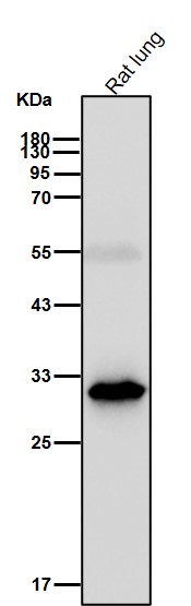 p53 DINP1 Ab