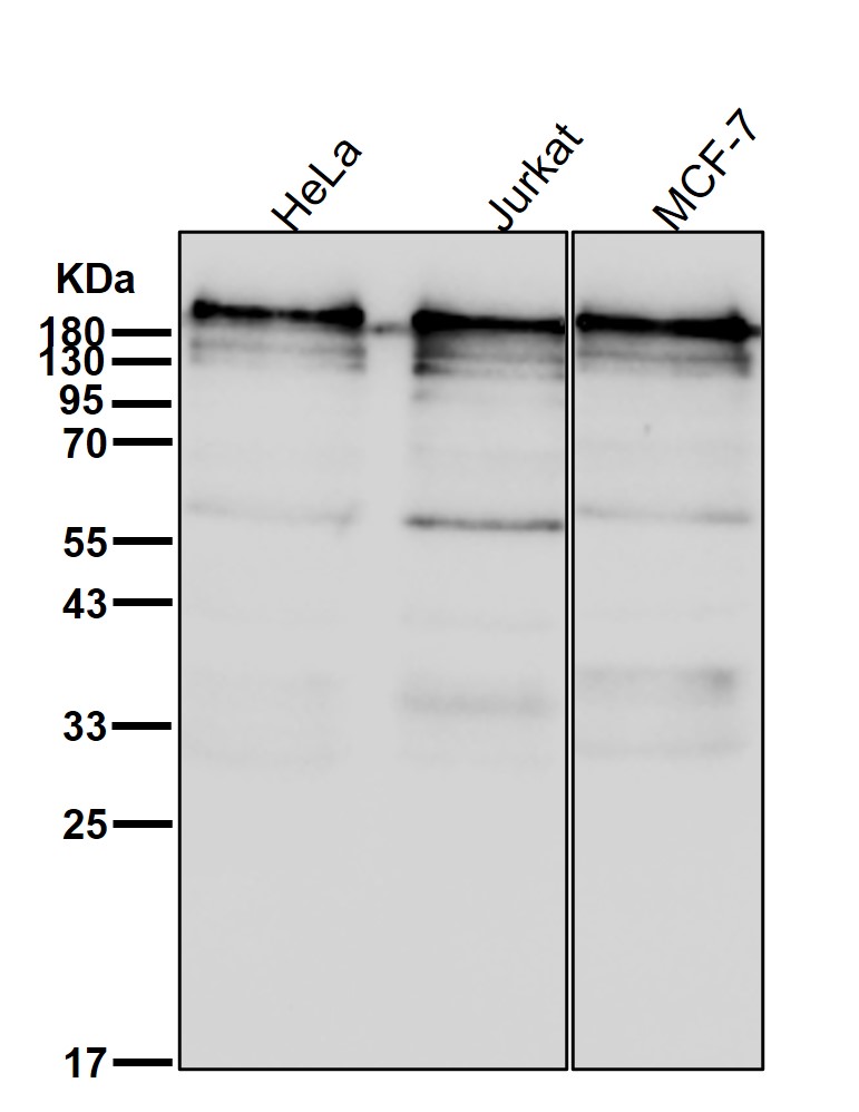 KDM5A Ab