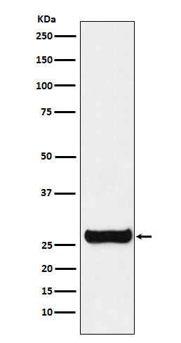 GSTM1 Ab