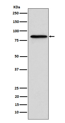 Gelsolin Ab