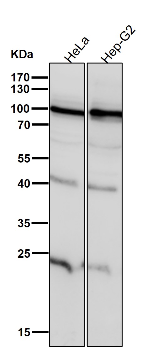 Gelsolin Ab