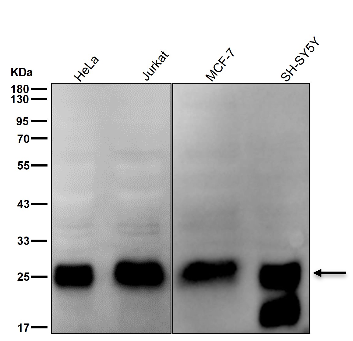 CK II beta Ab