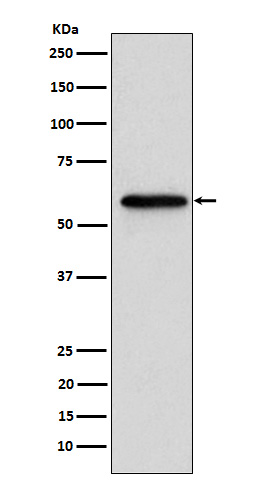 Retinoic acid receptor beta Ab