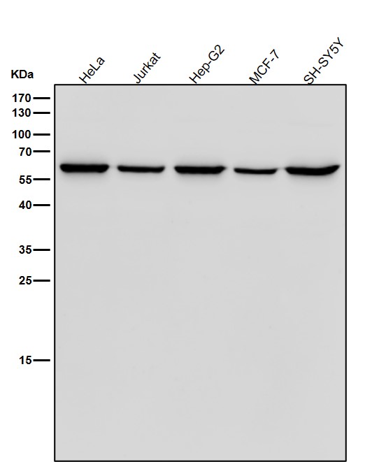 Retinoic acid receptor beta Ab