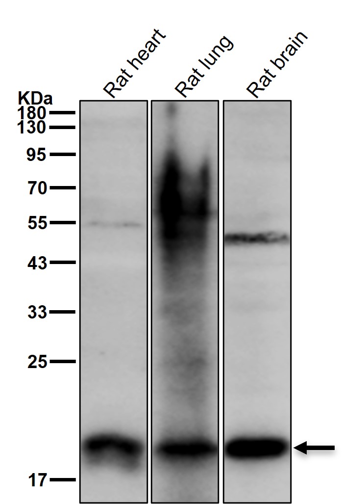 SOCS 2 Ab