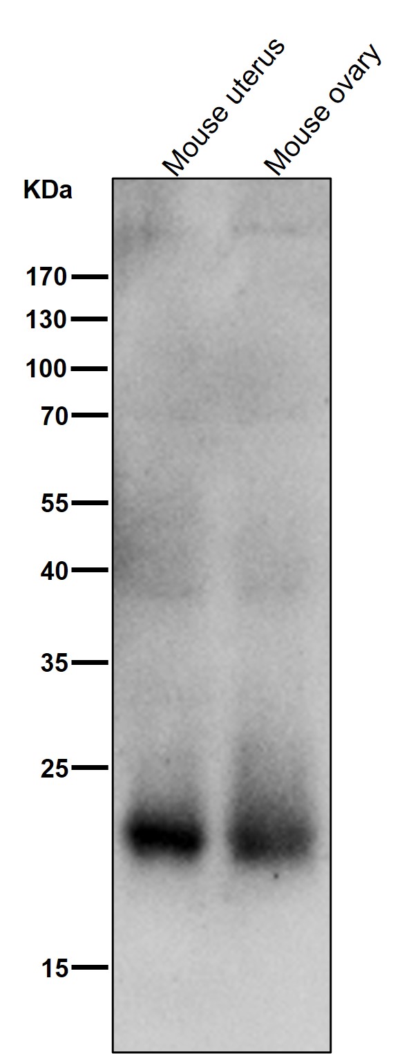 SOCS 2 Ab