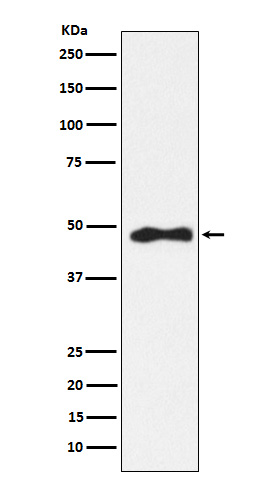 AP 2 alpha Ab