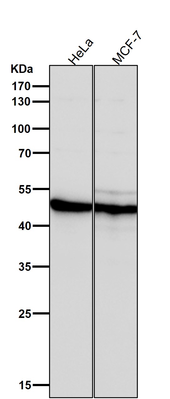 AP 2 alpha Ab