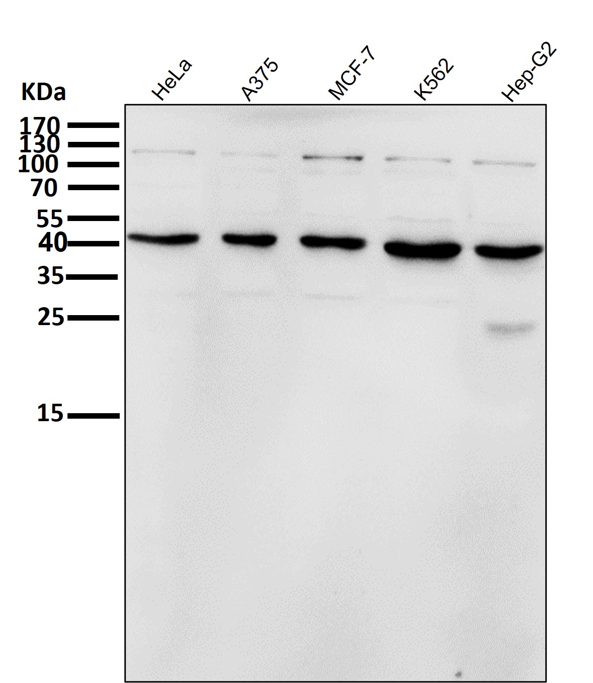 Inhibin beta A chain Ab