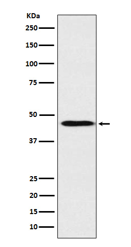 Apolipoprotein A4 Ab