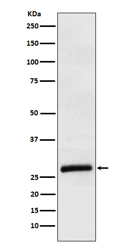 Apolipoprotein M Ab