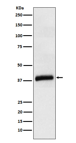 Apolipoprotein L1 Ab