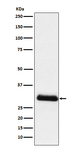 Apolipoprotein D Ab