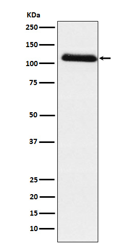 Fibrinogen alpha chain Ab