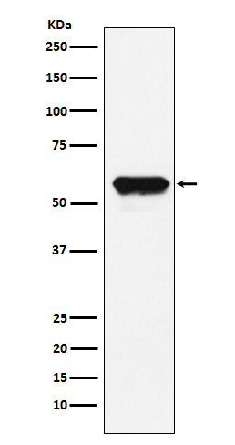 Angiotensinogen Ab