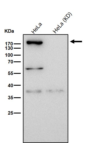 Complement C3 Ab