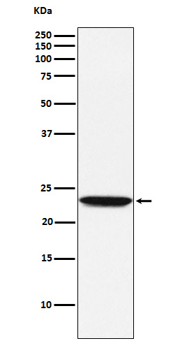 Tetranectin Ab