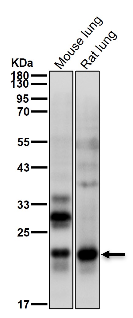 Tetranectin Ab