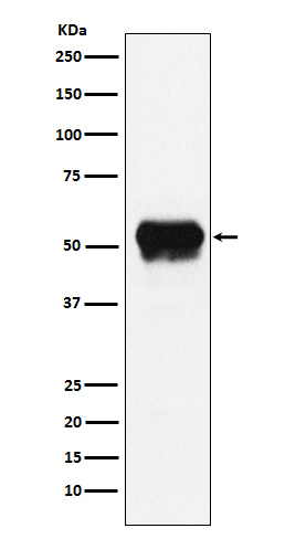 Fibrinogen gamma chain Ab