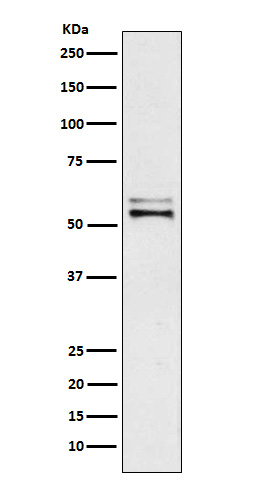 Angiotensinogen Ab