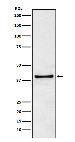 TRIB3 Ab