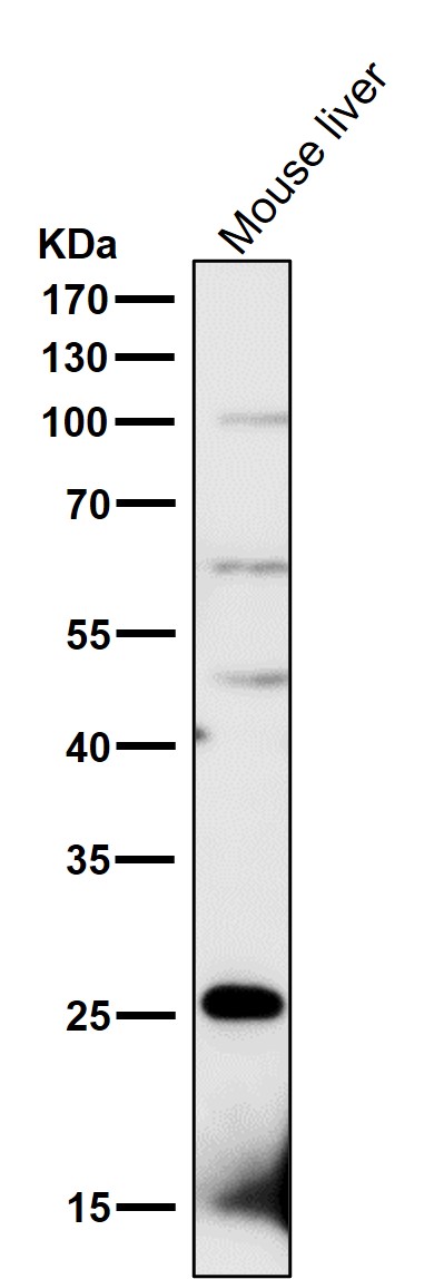 CD52 Ab