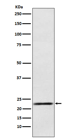 Prolactin Ab