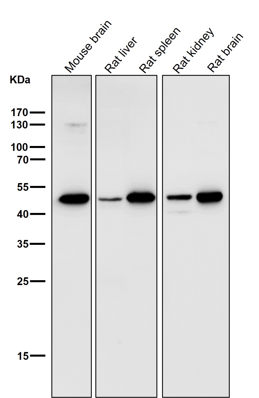 LIS1 Ab