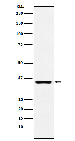 TNFRSF10D Ab