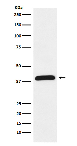 HIF 1 alpha inhibitor Ab