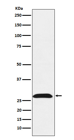 RhoGDI 1 Ab