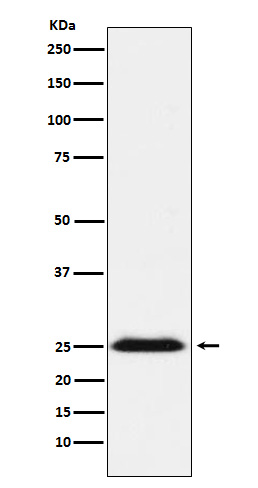 BCAP31 Ab