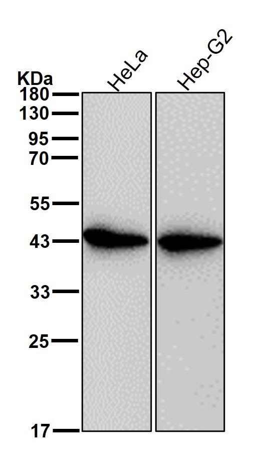 Creatine kinase B type Ab