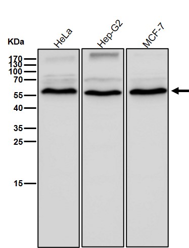 Activin receptor type 1 Ab