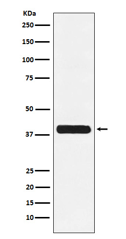 Glycophorin C Ab