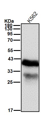 Glycophorin C Ab