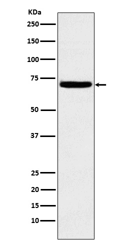 Heparanase Ab