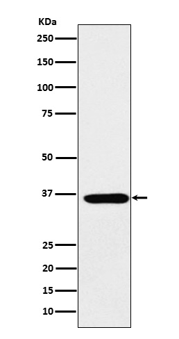 SMN1 Ab