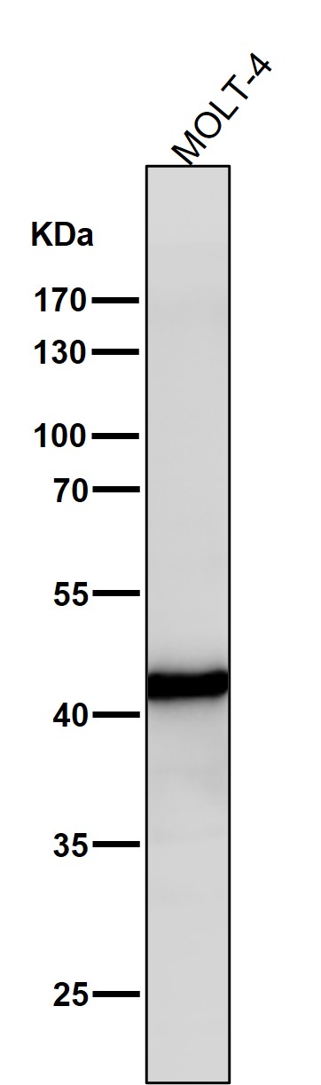 Adenosine deaminase Ab