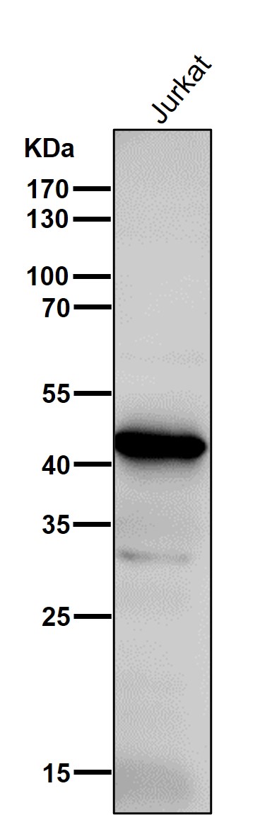 Adenosine deaminase Ab