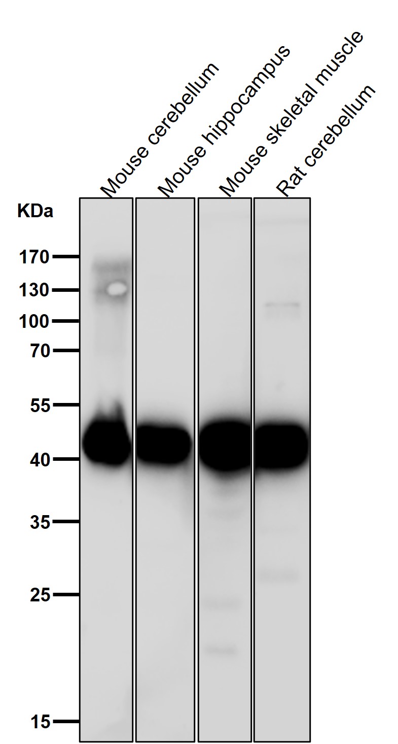 Adenosine deaminase Ab