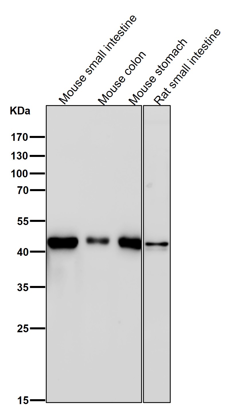 Adenosine deaminase Ab