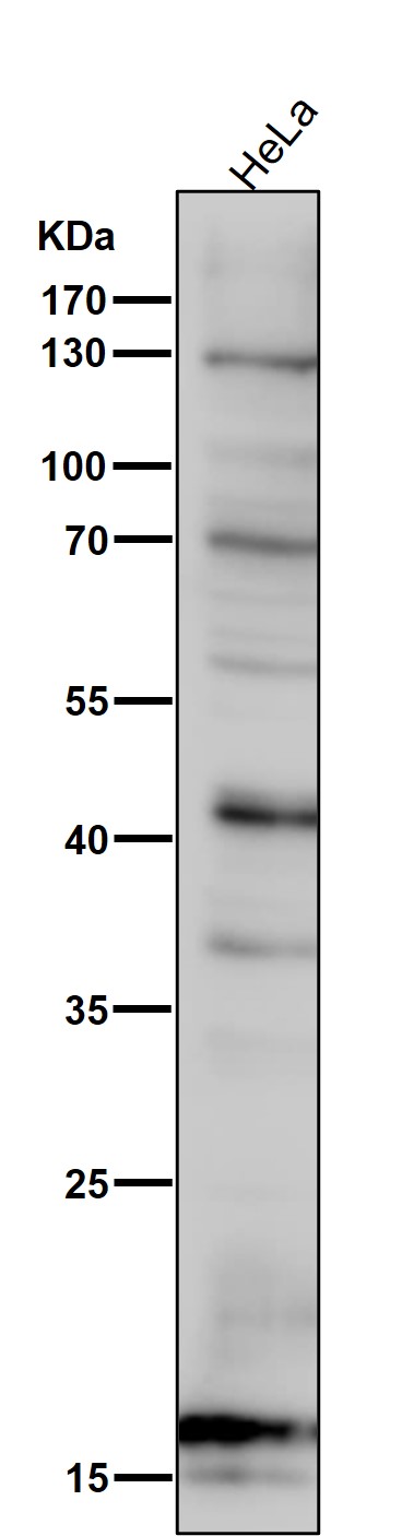 SDHC Ab