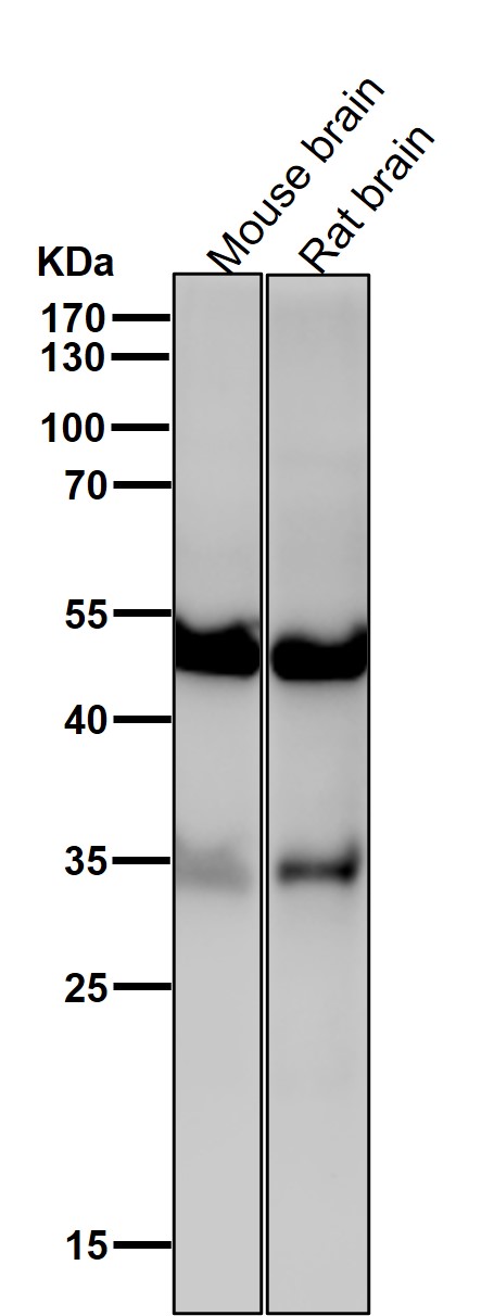 ACVR1B Ab